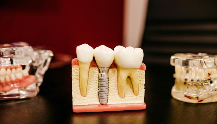 Los Mejores Planes Dentales en México