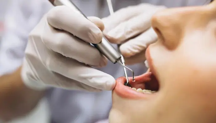 NIB Dental Services: Everything You Need to Know