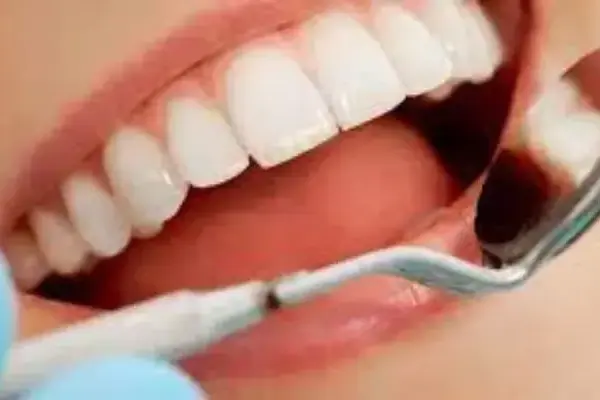 Benefícios dos Planos Amil Dental: Por que Escolher?